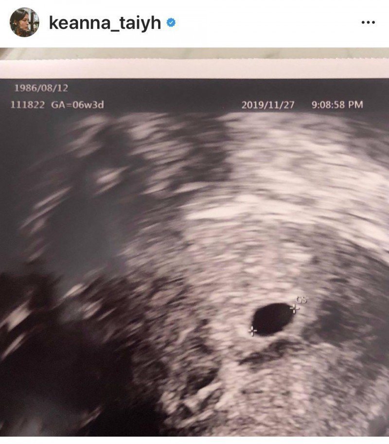 謝和弦老婆Keanna昨晚分享超音波照，目前懷孕近8週。圖／摘自IG