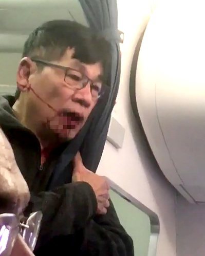 華裔醫師杜成德9日晚從芝加哥搭乘「聯合航空」班機前往路易維爾，遭聯航無理對待，出...
