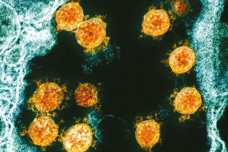 內華達州一名25歲男子，成為全美第一個已知的新冠病毒再度感染個案。圖中彩色電子顯微鏡圖像顯示新型冠狀病毒SARS-CoV-2病毒顆粒（橙色）。 美聯社