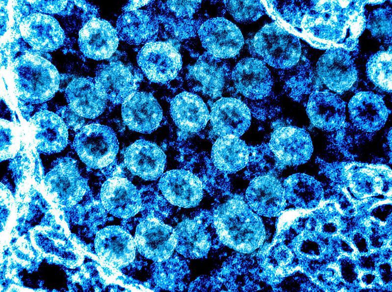 新冠病毒不断突变之际，美国总确诊数也在1日突破3500万大关，图为电子显微镜下的病毒模样。法新社(photo:UDN)