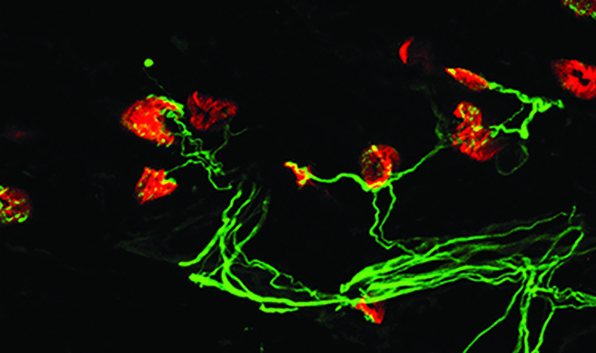 研究團隊取出生後第7天的健康小鼠肋間肌組織縱切片，利用免疫螢光染色法標誌出運動神經元軸突 (綠色) 與神經肌肉交界終板 (紅色)，於共軛焦顯微鏡下觀察並攝影。圖／高雄醫學大學提供