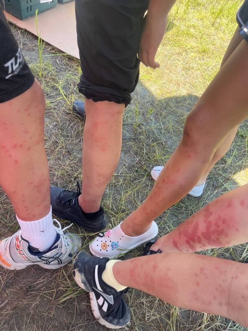 台灣童軍在南韓露營，雙腿被咬成「紅豆冰」。圖／讀者提供
