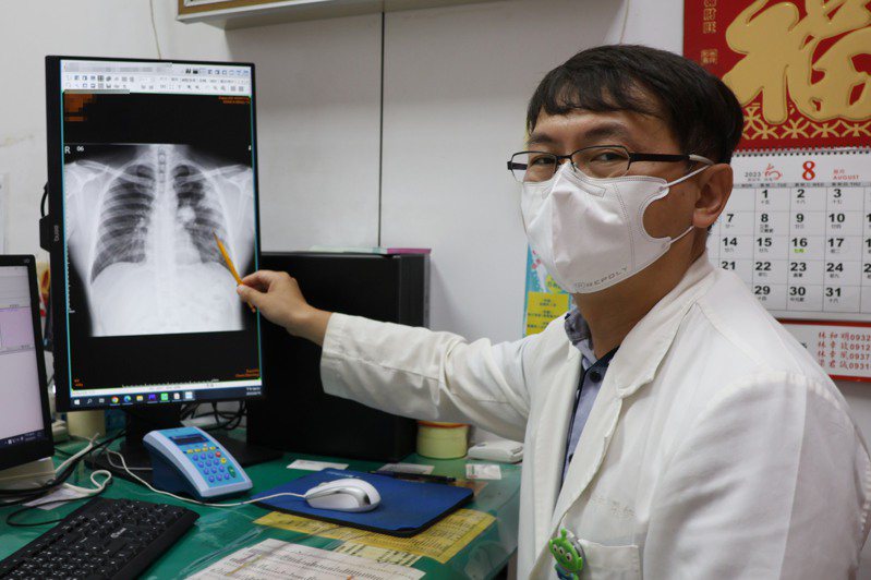 大甲李綜合醫院胸腔內科主治醫師黃朝新表示，一名移工自覺身體硬朗卻罹癌。記者游振昇／攝影
