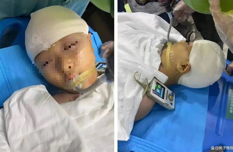 湖南一小學家長稱孩子被教師打碎頭骨，進行開顱手術後仍處於危險期。（揚子晚報）