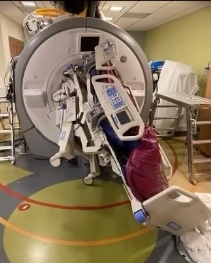加州一名護理師被核磁共振機（MRI）與病床夾住，導致兩顆螺絲直接卡入體內，造成嚴重撕裂傷。圖／擷自《Mail online》