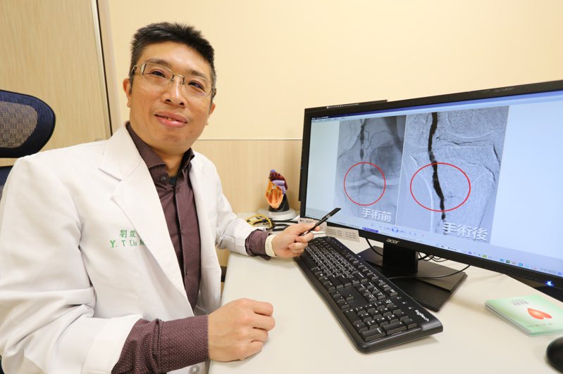 亞洲大學附屬醫院心臟外科主任劉殷佐說，只要發現有周邊動脈阻塞情形，透過藥物或手術治療都能改善症。圖／亞洲大學附屬醫院提供
