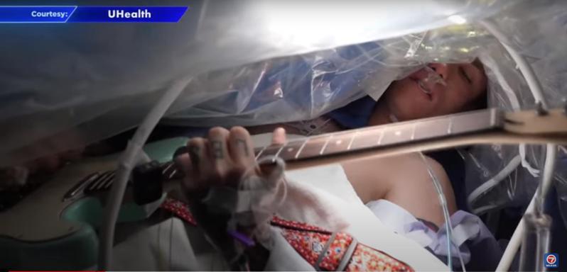 美國佛州吉他手諾倫一邊接受開顱手術一邊彈奏吉他。取自YT影片