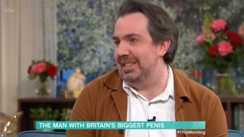英国一名40岁男子马特巴尔登上英国谈话节目《This Morning》，道出生殖器尺寸比多数人还大的困扰。图截自(photo:UDN)
