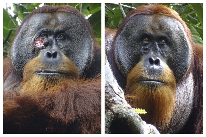 印尼一隻雄性蘇門答臘紅毛猩猩用植物自製藥膏，並反覆塗抹在臉上的傷口，1個月後傷口痊癒。美聯社