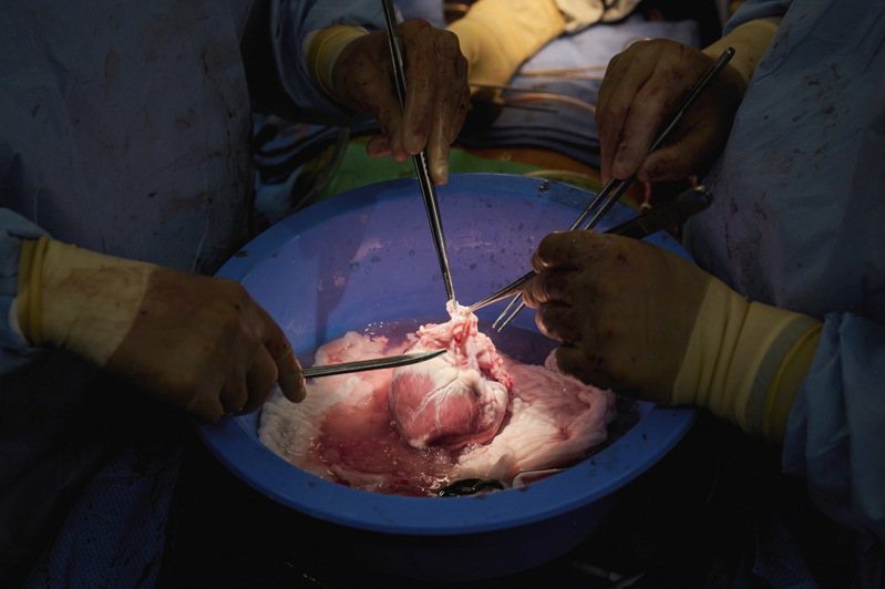 纽约大学医学中心外科团队取出转基因猪心，准备移植到脑死病人身上。(美联社)(photo:UDN)