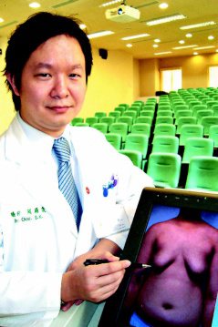 中國附醫整形外科醫師周爾康說，14歲國中男生因「男性女乳症」，胸部異常隆起並下垂，患者因自卑感，常彎腰走路，造成駝背。（記者胡宗鳳／攝影）