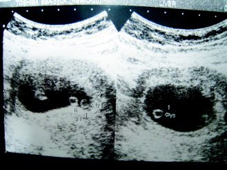 超音波影像下，母親腹中胚胎靜靜等待長大。不孕生殖技術進展，減胎成為必要之惡，一開始就從嚴管制胚胎植入數，才是人道作法。（圖／聯合報系資料照片、記者陳立凱攝影）