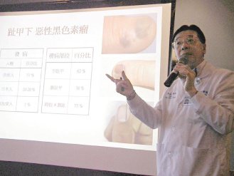 雙和醫院放射腫瘤科旋弧刀中心主任梁永昌提醒民眾注意惡性黑色素瘤發病部位和百分比。（記者張祐齊／攝影）