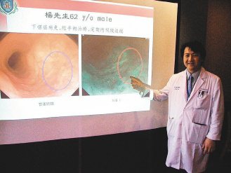 透過「窄頻影像系統」(NBI)所發出的藍綠色光線照射，若有癌變，就會顯現出咖啡色斑塊(如圖右)，較傳統胃鏡可更早找到初期病灶。（記者張祐齊／攝影）
