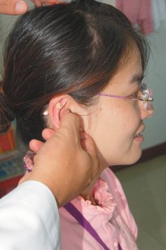 署彰中醫師運用耳穴貼壓改善婦女更年期症狀。 記者林宛諭／攝影