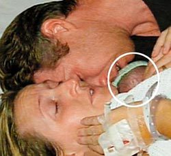 早產兒傑米出生後20分鐘被宣告死亡，母親把他抱在胸口，2 小時後傑米奇蹟復活。 （英國每日郵報）