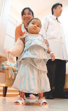 「象臂女童」瑞君妮來台治療，原本拖著沉重手臂無法行走，如今手臂「瘦」了，走得有模有樣。
記者洪敬浤／攝影