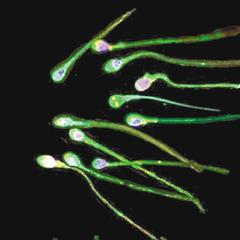 精子向前衝的過程，也常損兵折將，精子兵團抵達卵子後，一群精子會共同釋放&#37238;，以溶解卵外殼，再由一隻精蟲鑽進卵子中受孕。 （法新社、路透資料照片）非報系