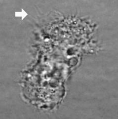 棘狀阿米巴原蟲在顯微鏡下狀態。 圖／衛生署提供
