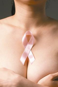 亞東醫院腫瘤科暨血液科主任林世強說，國內每年新增約一萬名乳癌患者，其中有四分之一的人屬於Her2陽性，代表Her2基因有過度表現情形，腫瘤容易復發及轉移。 圖／本報資料照片
