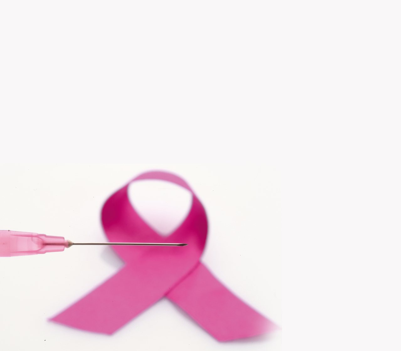 根據台灣癌症登記資料庫，乳癌是女性癌症第一位、死亡第四位。尤其台灣乳癌好發年齡比歐美年輕10至15歲。