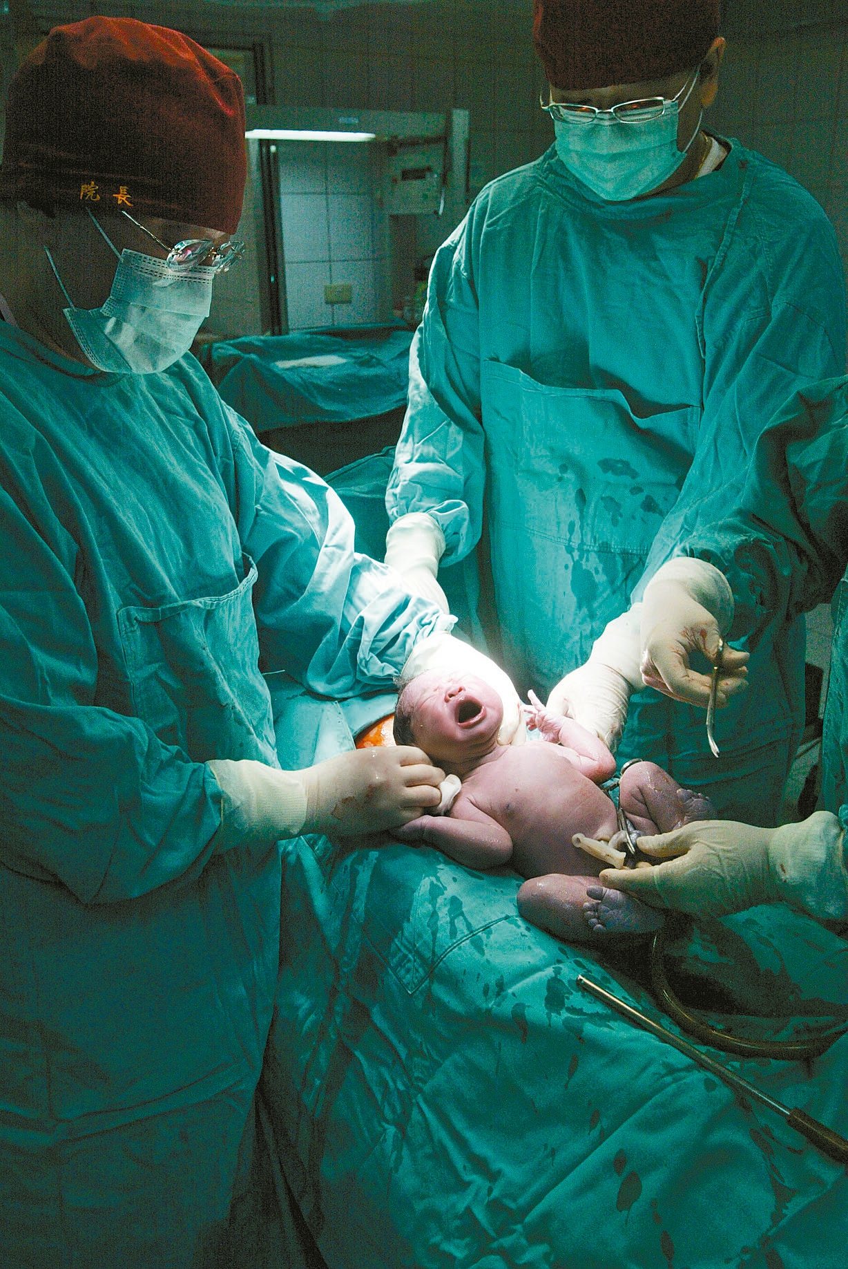 美婦產科醫師學會建議，不要太快剪斷新生兒的臍帶。