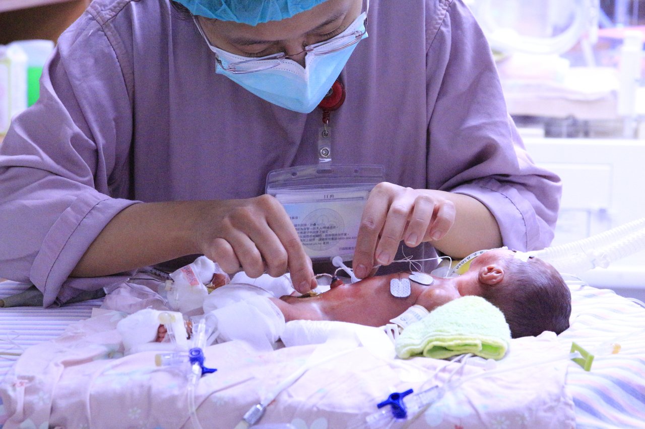 醫事人員正在為早產兒進行照護。