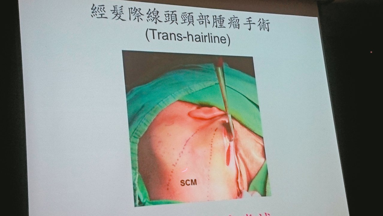 台大醫師楊宗霖發表髮際線頭頸部腫瘤切除術。