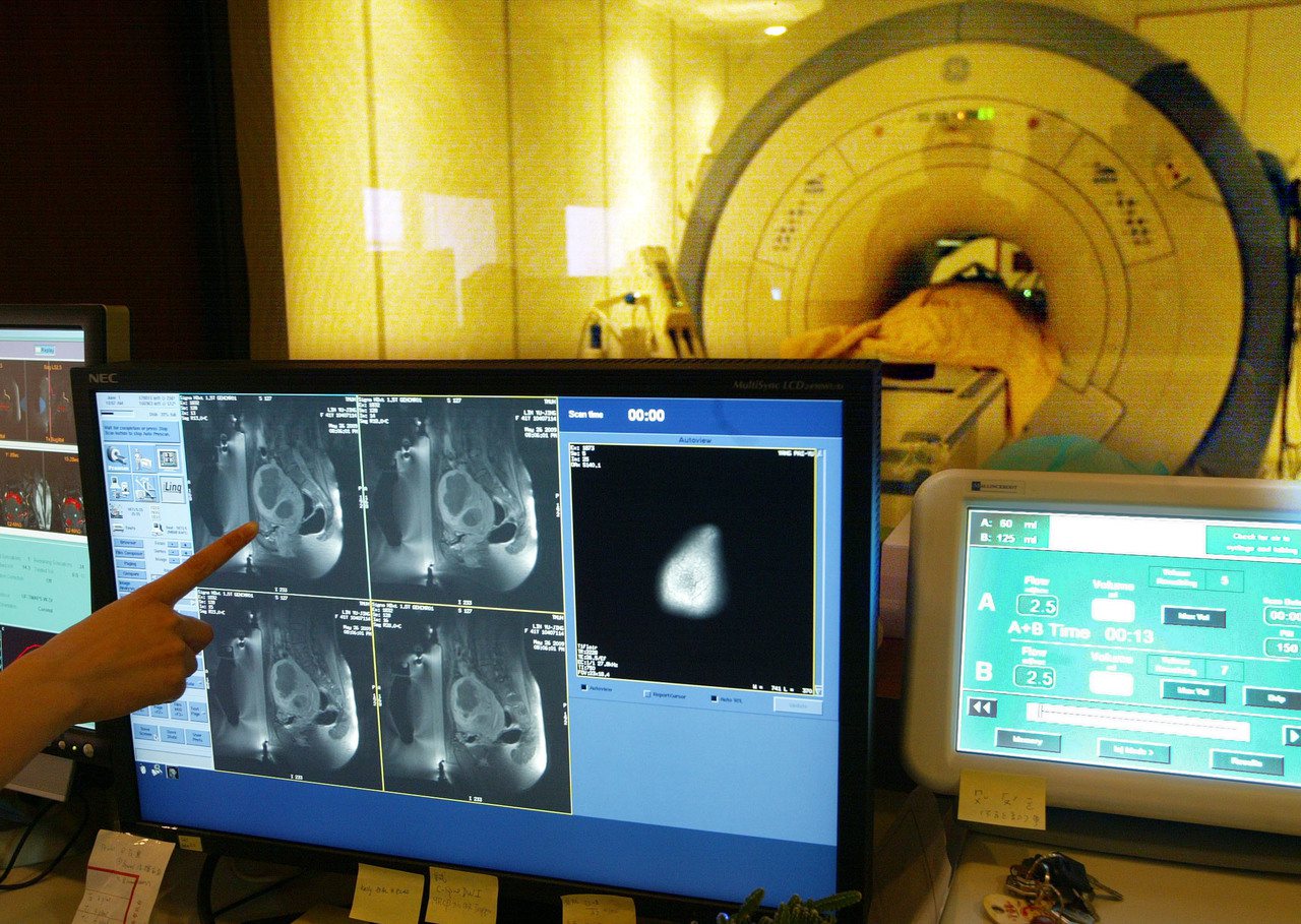 磁振導航超音波診查子宮肌瘤。示意圖，非新聞當事人。本報資料照片／記者林俊良攝影