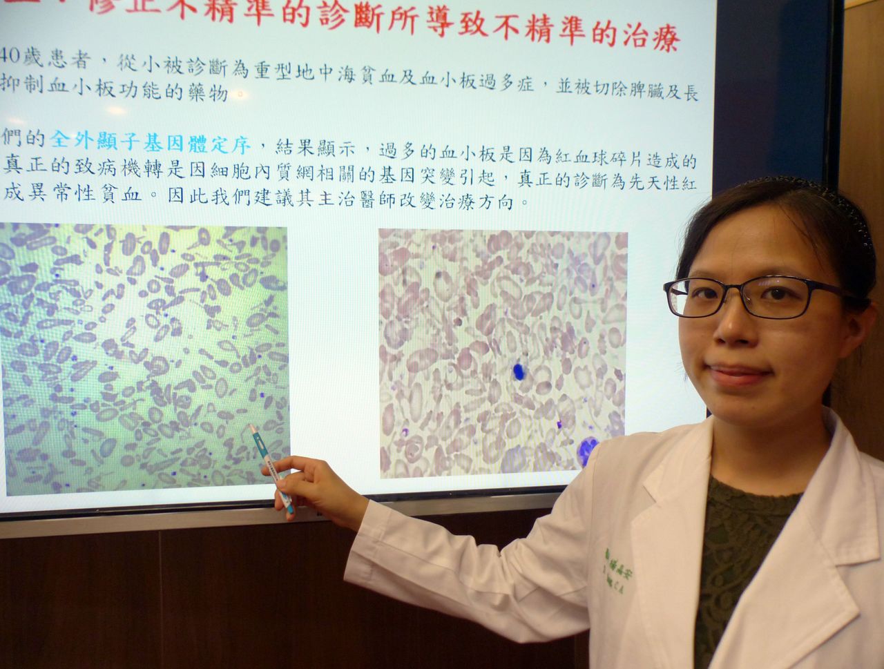 醫師楊晶安說明，女病患因紅血球碎片看起來像血小板，被誤當原發性血小板增多症治療。記者趙容萱／攝影