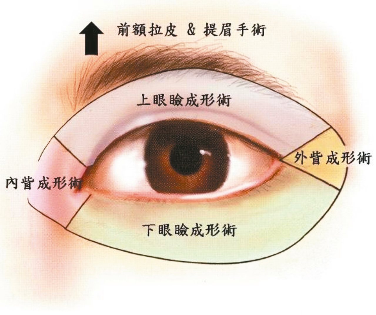 眼眶周圍的美容手術包括前額拉皮與提眉手術、上眼瞼成形術（雙眼皮手術、上眼瞼拉皮手術、提眼瞼肌縮短術）、下眼瞼成形術（眼袋手術）、內眥成形術（眼頭手術）、外眥成形術（眼尾手術）。