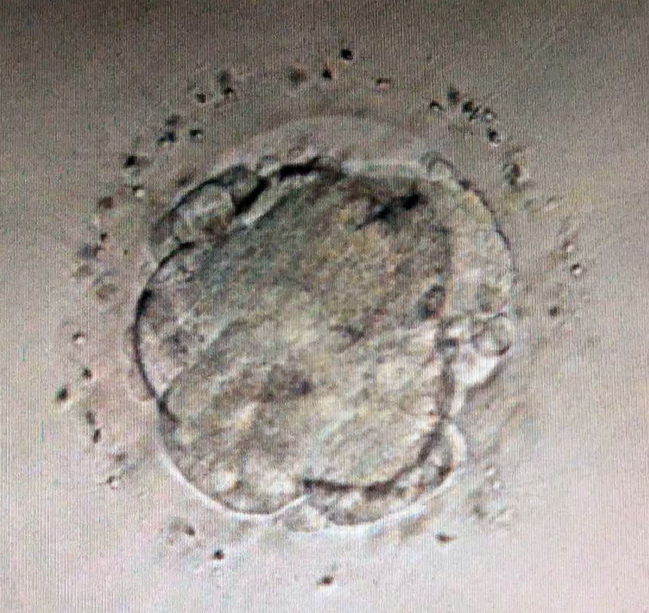 高雄長庚醫院取捐贈者的卵子製成人工胚胎（見圖）植入不孕症患者子宮，讓他們也有機會傳宗接代。圖／高雄長庚婦產部提供