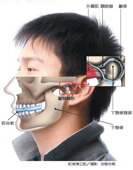顳顎關節示意圖。 圖／報系資料照