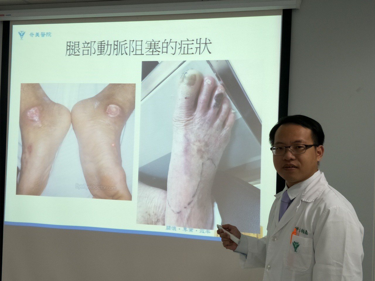 台南佳里奇美醫院醫師黃柏森提醒，腿部行走痠痛，小心是動脈血管阻塞，嚴重者甚至須截肢。記者謝進盛/攝影