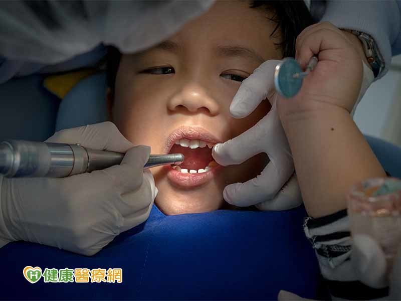 兒童抗蛀牙塗氟　這些事要注意！