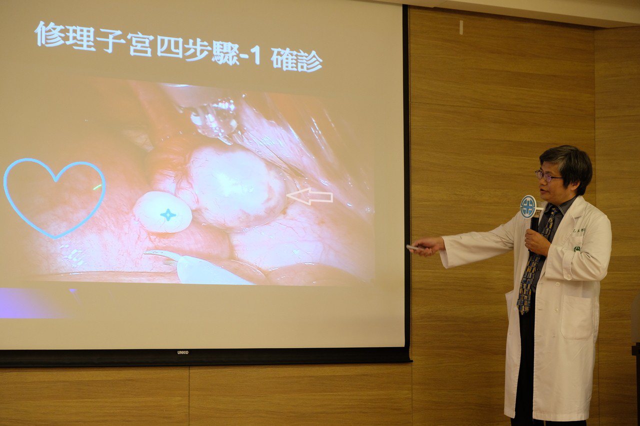 婦產部醫師莊乙真解釋如何用達文西手臂切除子宮肌瘤。記者張曼蘋／攝影