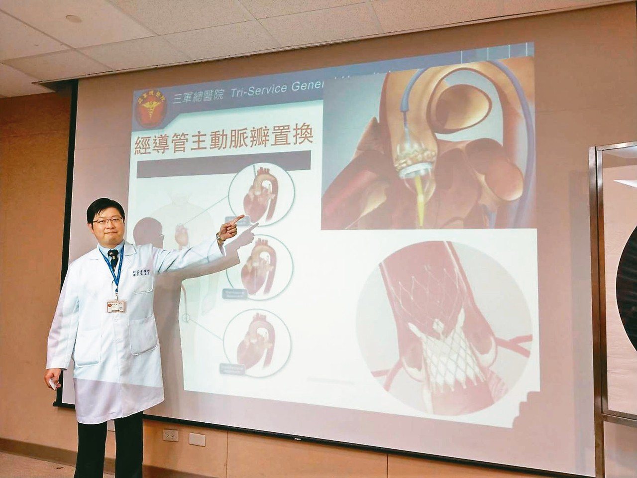 三總心臟血管外科醫師柯宏彥表示，微創經導管主動脈瓣置換手術可取代傳統開胸手術。