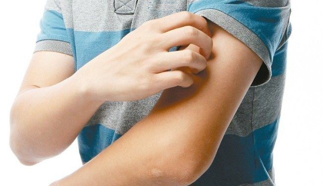 疾病管制署今公布，國內新增2例麻疹境外移入病例，均為北部31歲男性。本報系資料照