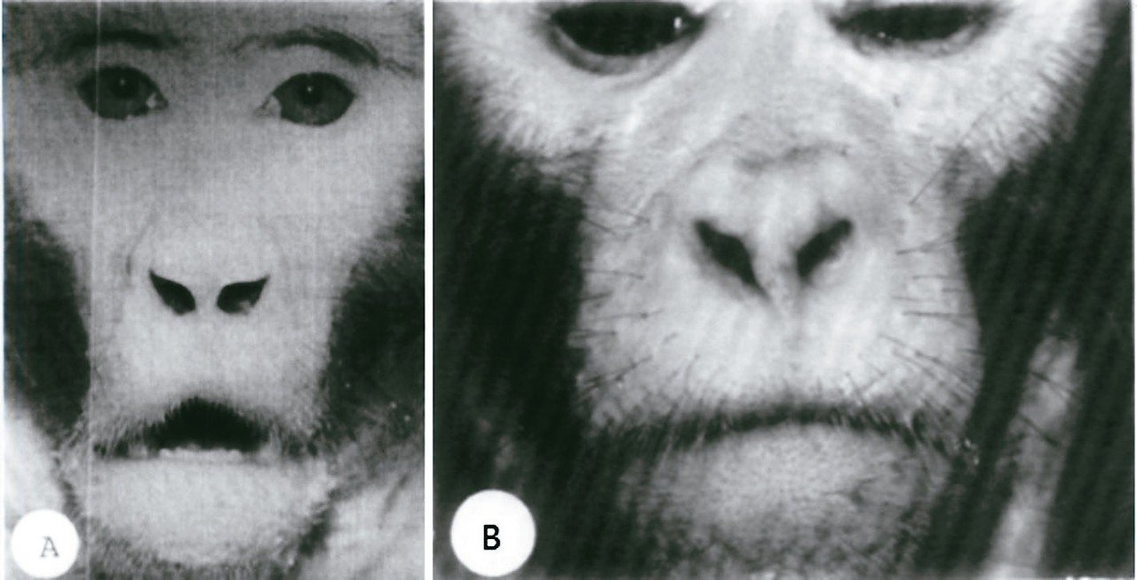 A：經過阻塞鼻孔三年後，該猴子維持口呼吸的習慣，可見到上唇之唇形改變，在嘴唇中央產生的一個孔縫。<br>
B：正常的唇形。原本有口呼吸習慣的猴子，在回復以鼻子呼吸的習慣之後，唇形有所改變。<br>
