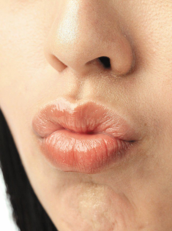 避免嘴唇乾裂，建議補充水分、避免抿嘴、塗抹護唇膏保護。圖╱聯合報系資料照