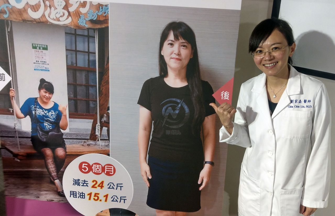 醫師劉家嘉（右）說明，45歲吳姓女業務員（左）原本體重106公斤，經接受胃內肉毒桿菌治療，搭配運動，如今（中）瘦到72公斤。記者趙容萱／攝影
