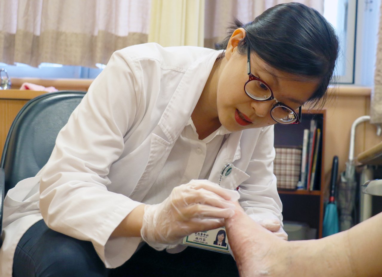 醫師提醒民眾，抺香港腳藥膏時要按摩，讓皮膚吸收藥效。圖／台中慈濟醫院提供