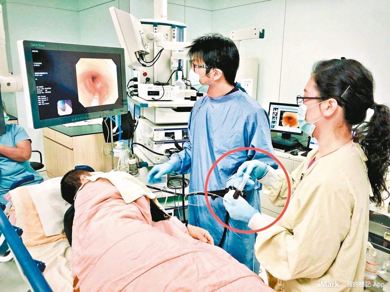 內視鏡的窄頻光譜影像技術(Narrow Band Imaging, NBI)，藉由濾光鏡，過濾出藍光及綠光，可將早期食道癌表面的血管病變突顯出來。