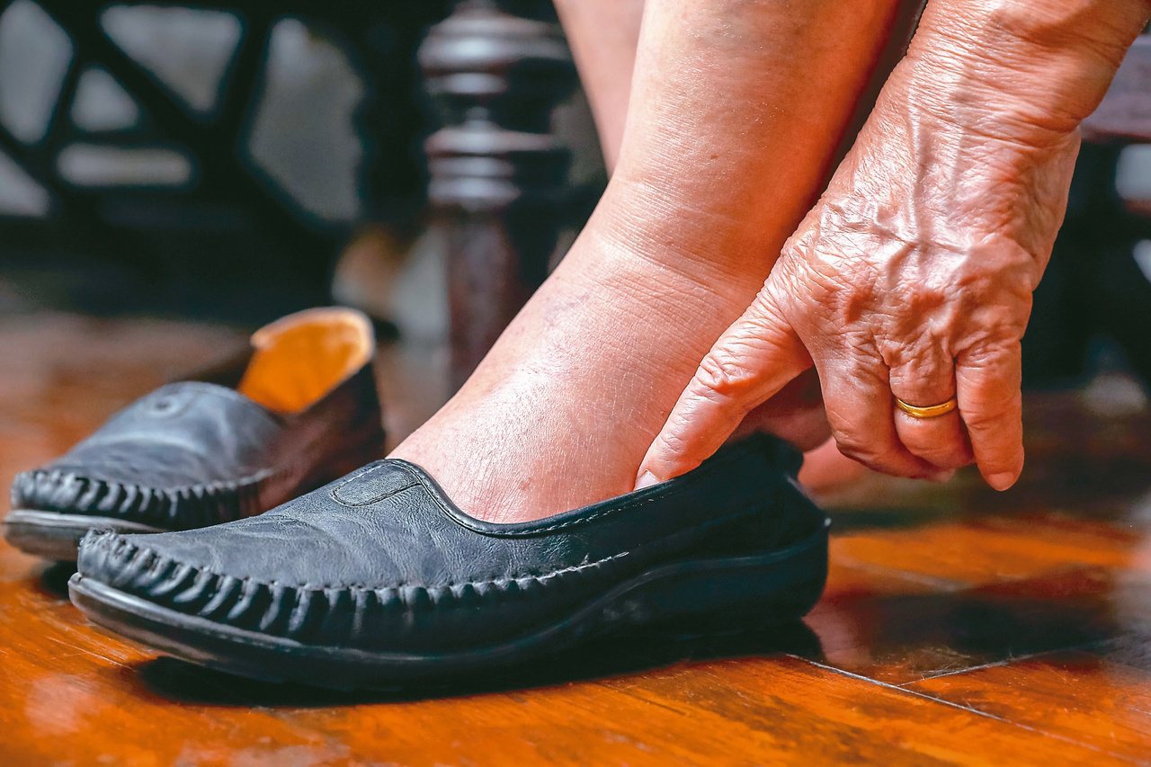 糖友別忽視挑鞋重要性，穿錯鞋恐引發足部病變。圖／123RF