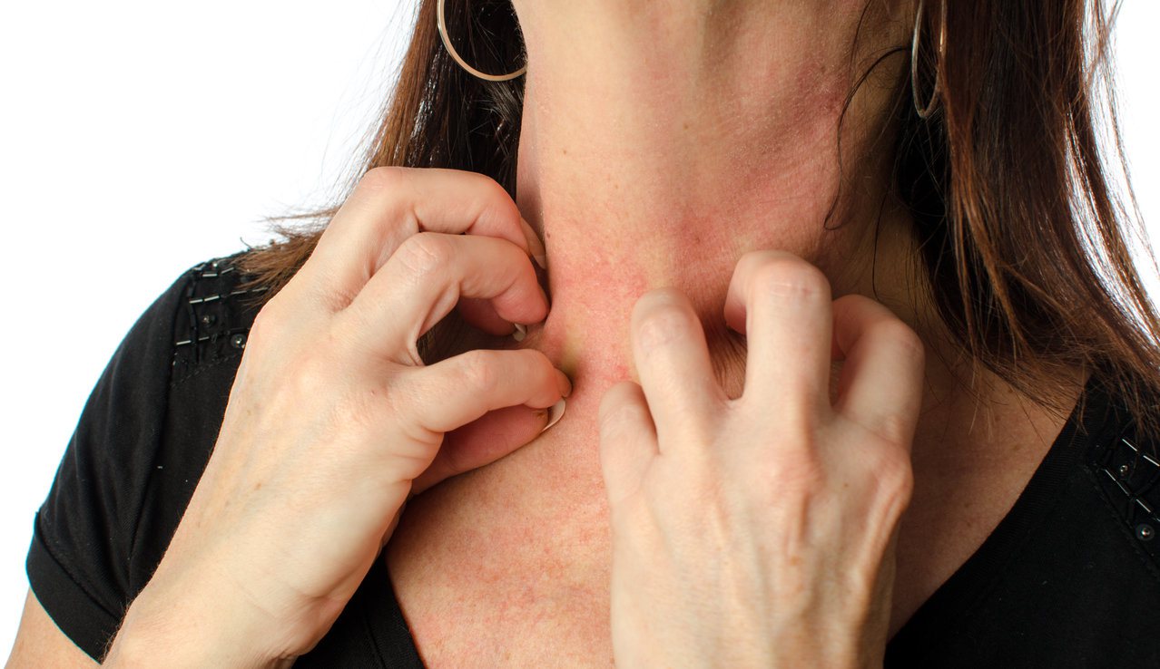 濕疹是各種發炎性皮膚疾病統稱。圖/123RF