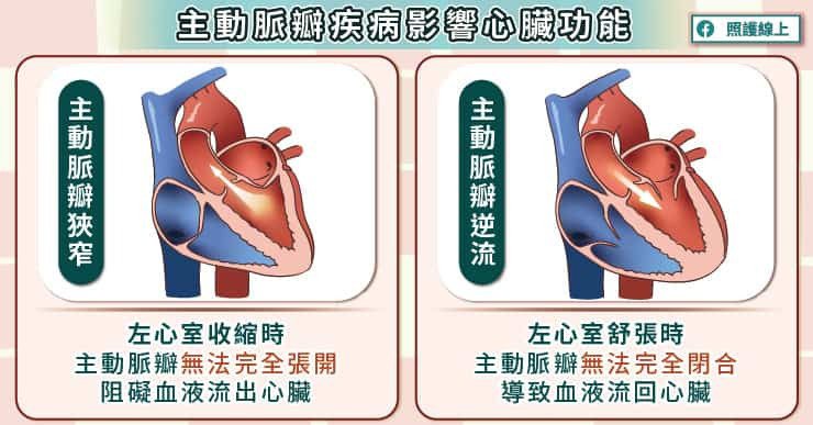 主動脈瓣狹窄時，血液無法在心臟收縮時順利流出心臟，使心臟必須更費力收縮，而身體則無法獲得足夠的血液供應。