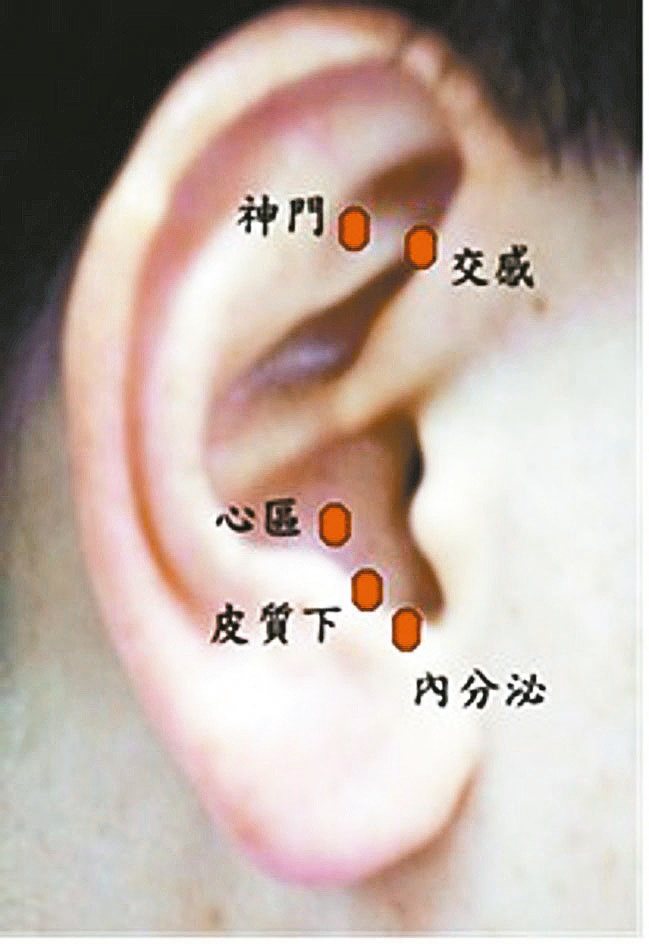 中醫觀點，可以透過耳穴貼壓療法促進經脈循行，發揮助眠、降壓療效。圖／北市聯合醫院提供