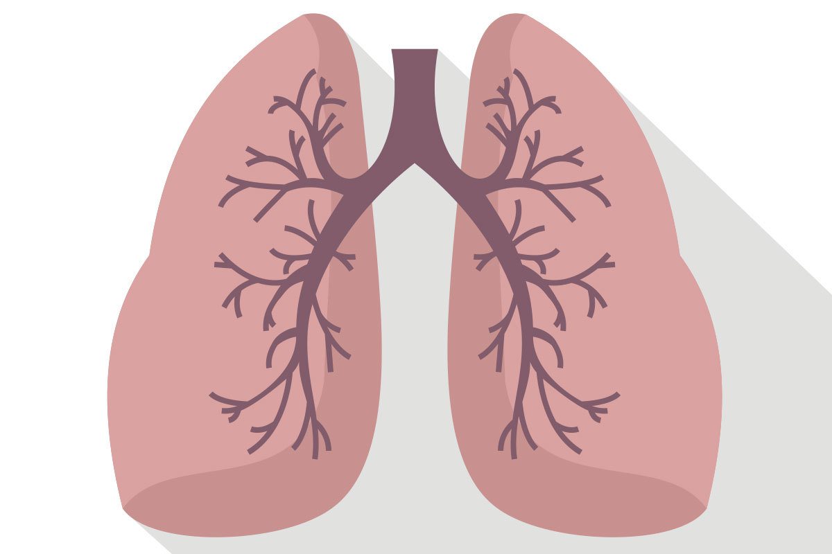 肺栓塞（Pulmonary embolism）與心肌梗塞、主動脈剝離並稱為心血管三大殺手。示意圖／ingimage。