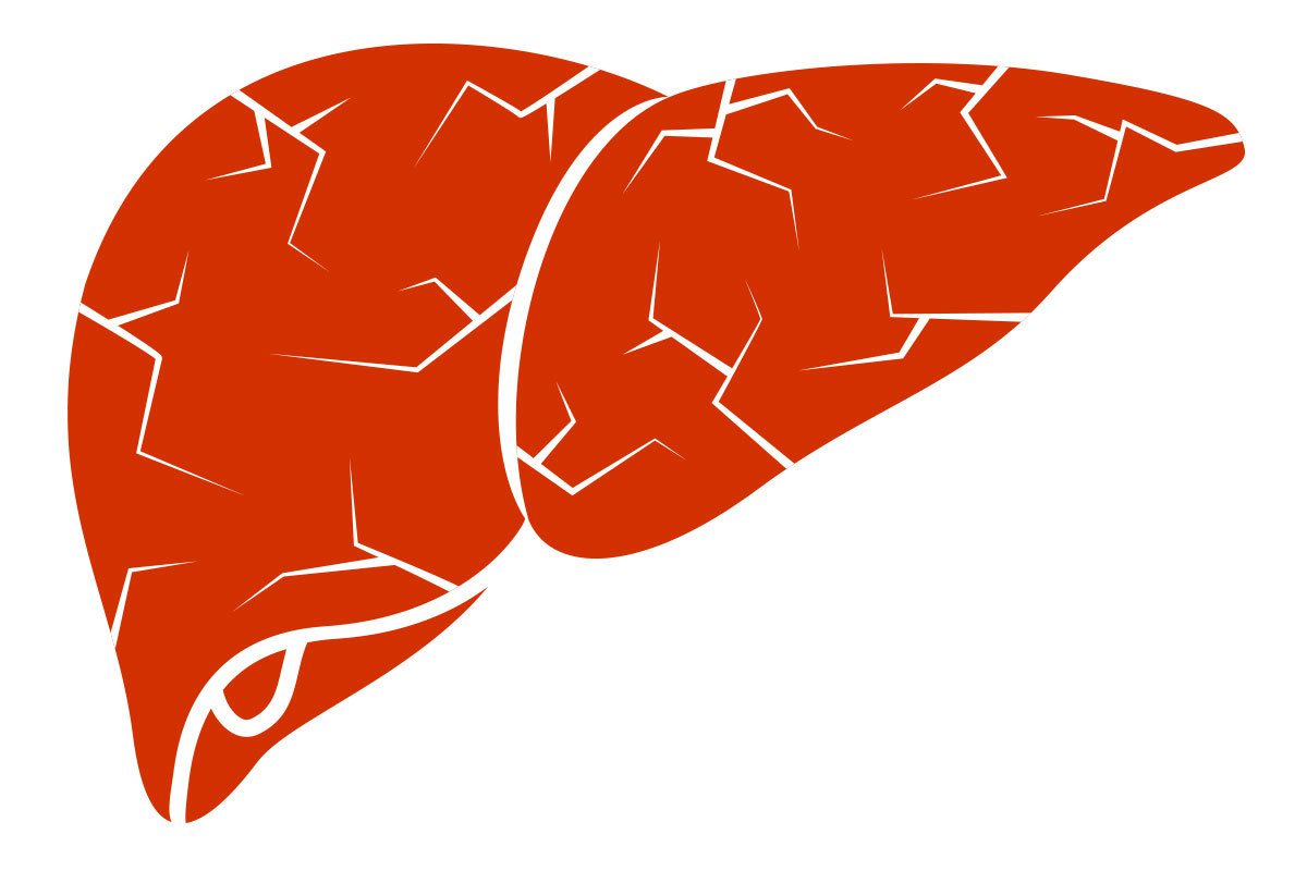 GOT與GPT數值正常不代表肝臟一定沒有問題，臨床上也常見肝硬化患者的GOT與GPT是正常的。