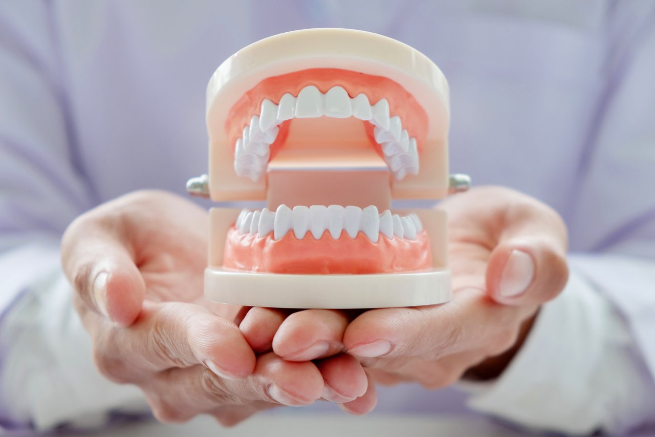 人工牙根材質多為鈦金屬，術後如果疏於清潔和保養，使牙菌斑長期堆積附著在植體表面，植體（植牙）周圍就會開始發炎。示意圖，圖片來源／ingimage。